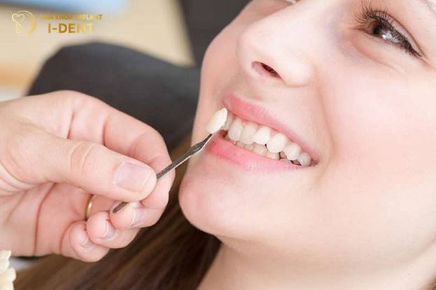 Có thể trồng răng khểnh “nhân tạo” bằng phương án bọc răng sứ, đắp Composite hoặc cấy ghép Implant 